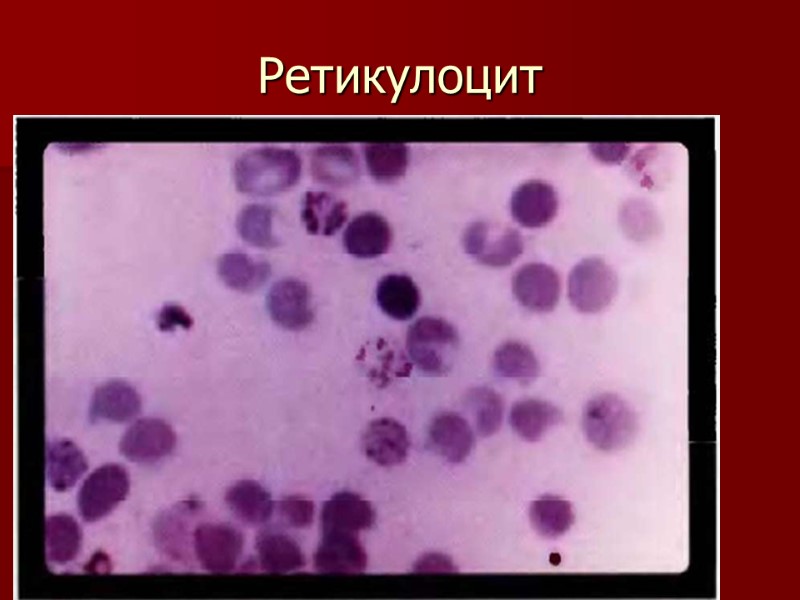 Ретикулоцит